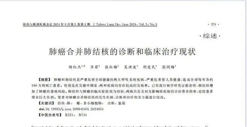 图片细节说明